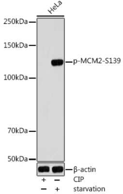 Western Blot: MCM2 [p Ser139] AntibodyAzide and BSA Free [NBP3-16941]